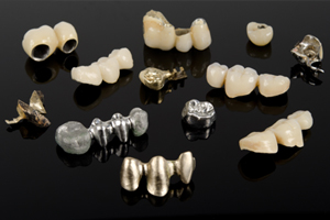 Dental Crowns And Bridges