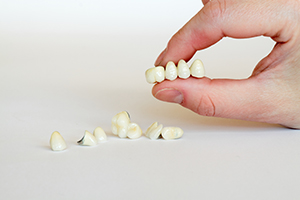 Dental Crown and Bridge